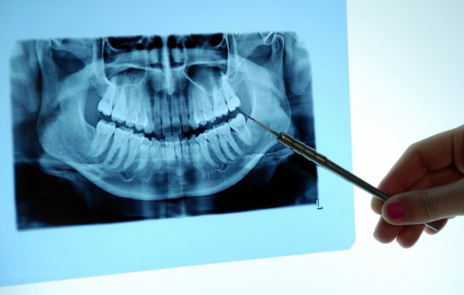 Dental Xray's Santa Clarita Advanced Dentistry