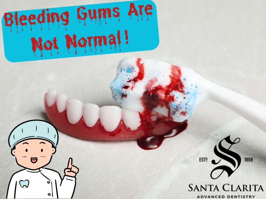 Bleeding Gums Are Not Normal