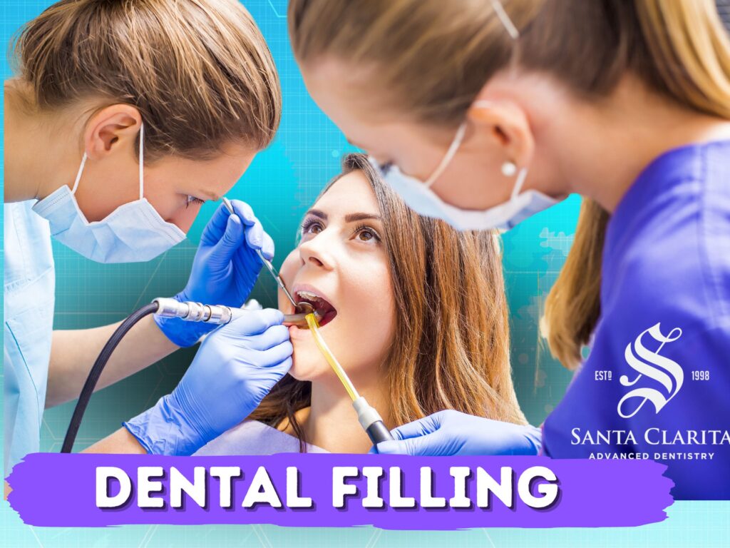 Santa Clarita Dentist - Dental Fillings - Restorative Dentistry