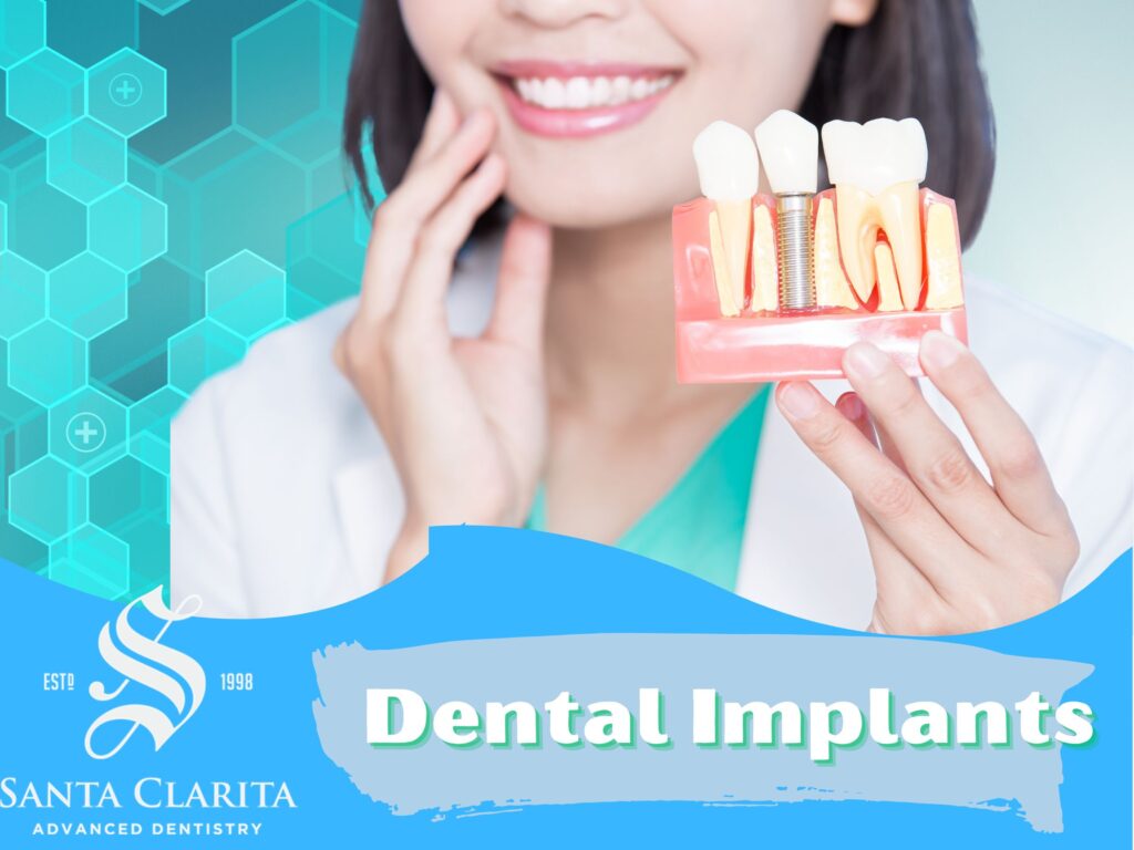 Santa Clarita Dentist - Dental Implants - Restorative Dentistry
