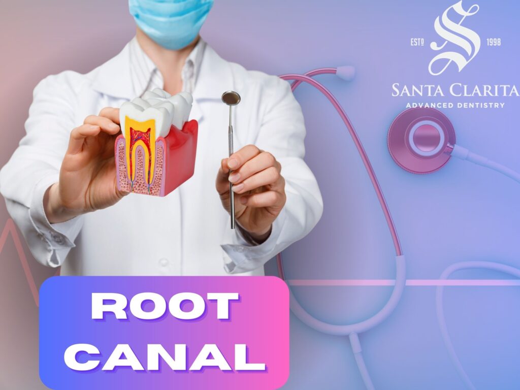 Santa Clarita Dentist - Root Canal - Restorative Dentistry