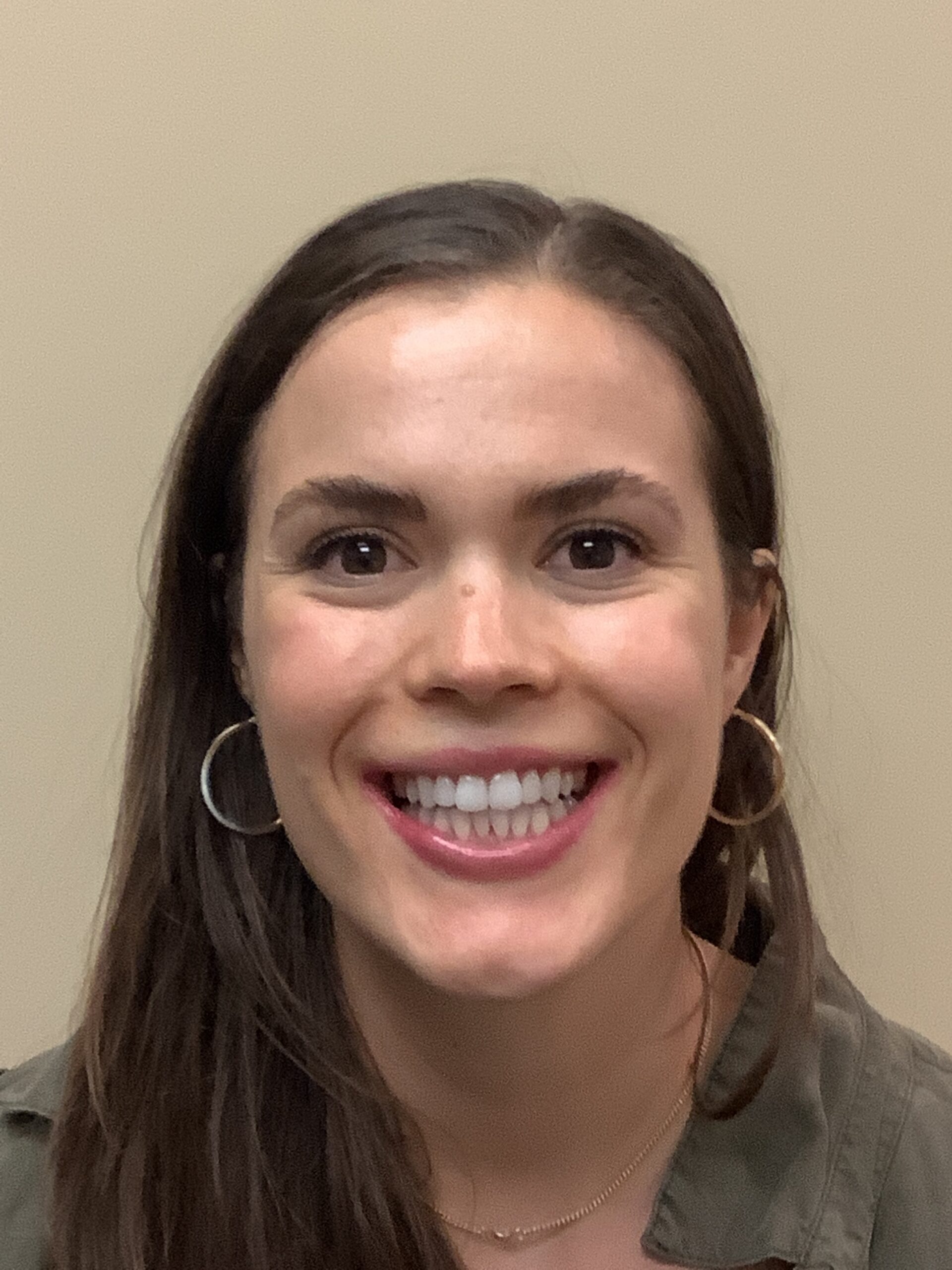 Invisalign before treatment