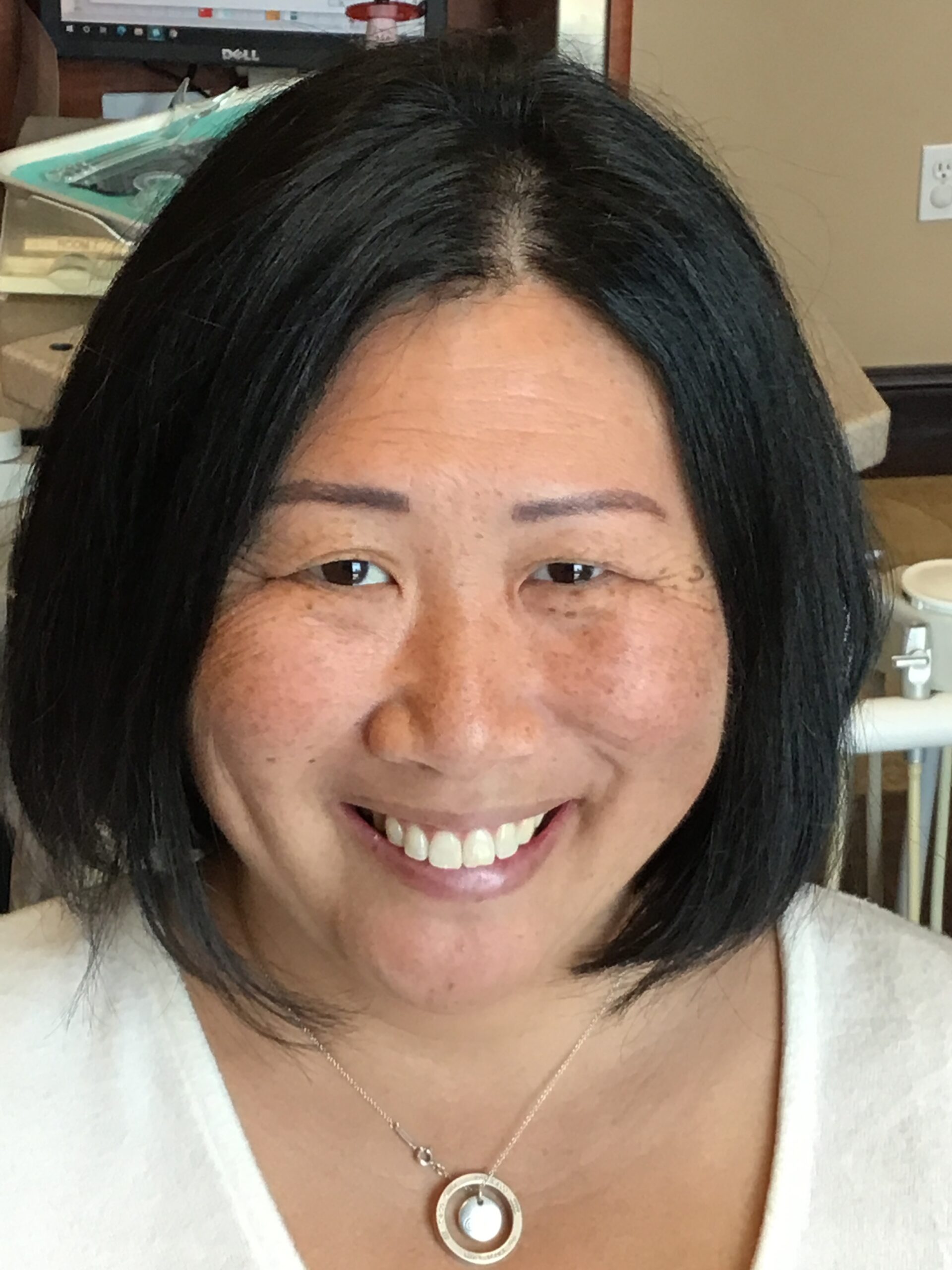 Invisalign before treatment