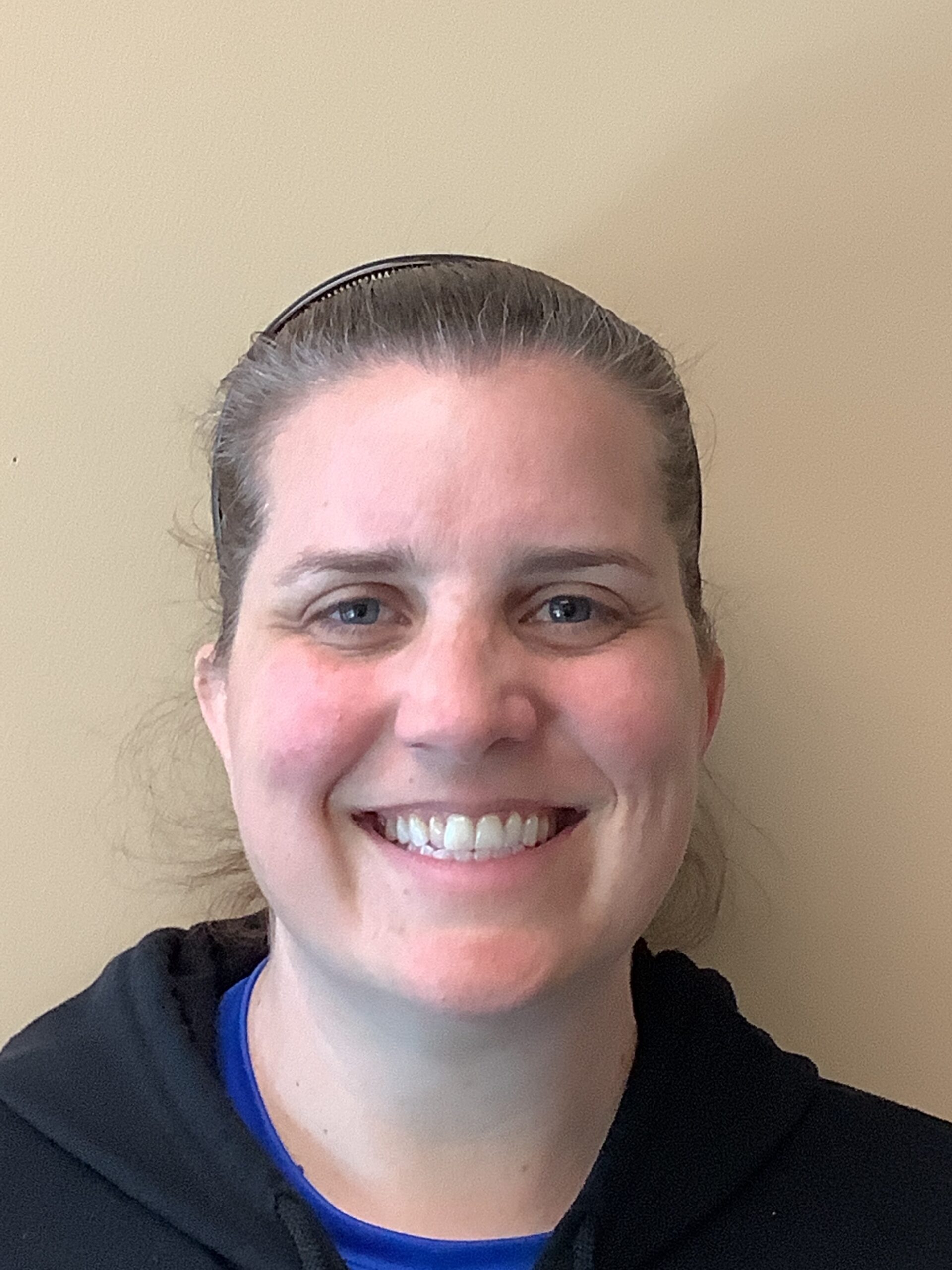 Invisalign® Clear Aligners before treatment