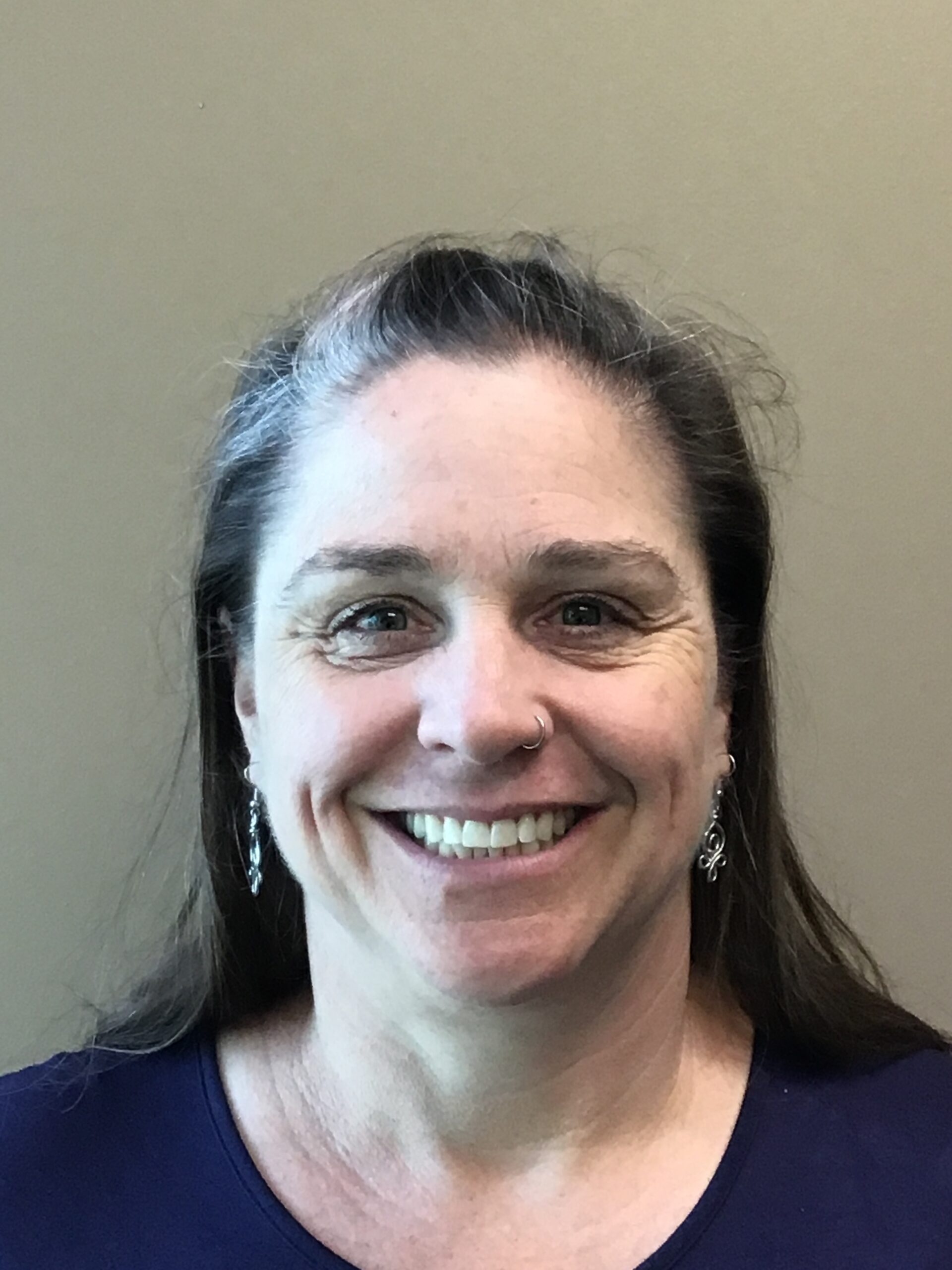 Smile Makeover before treatment